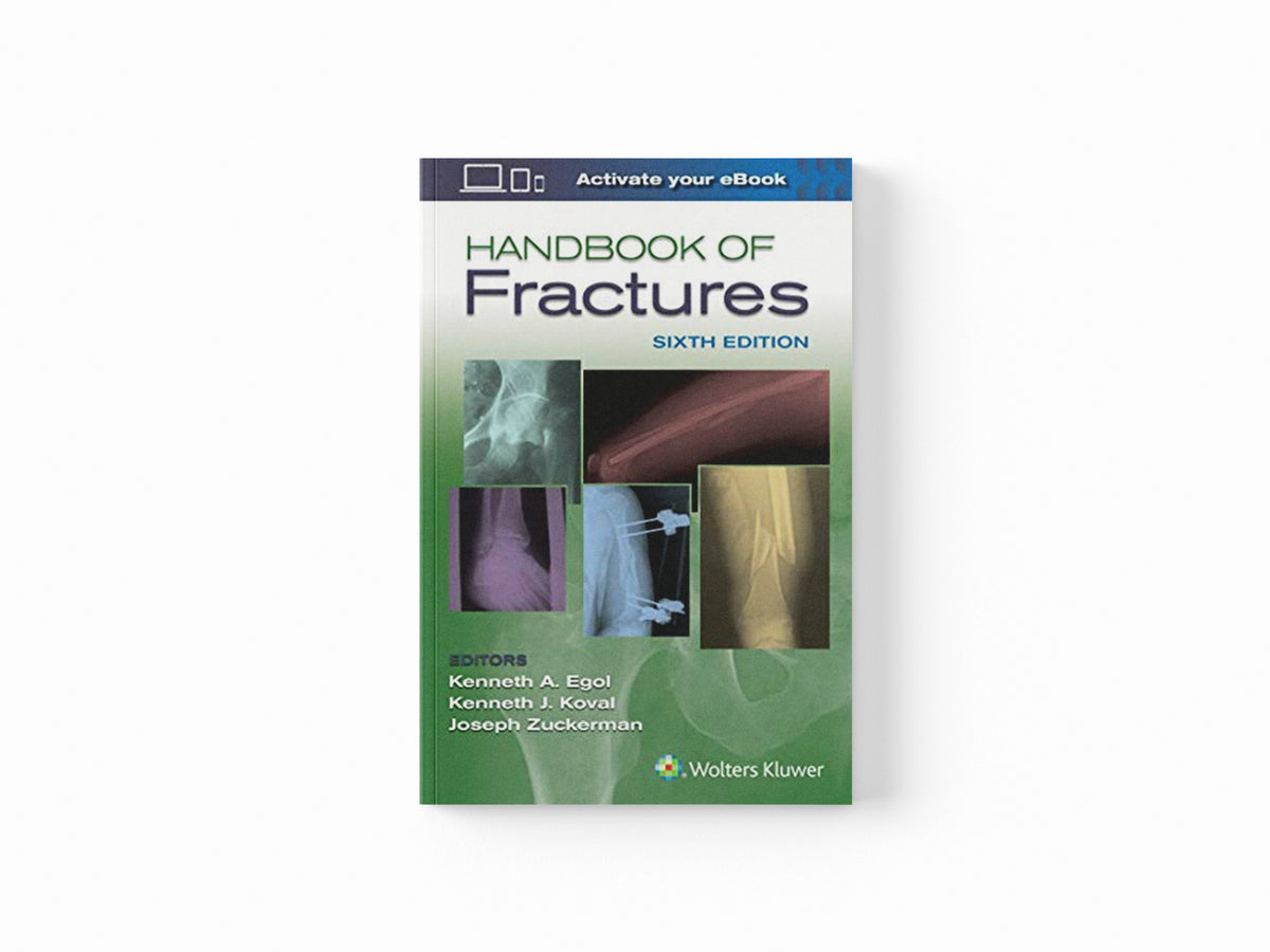 Handbook of Fractures; 9781496384850