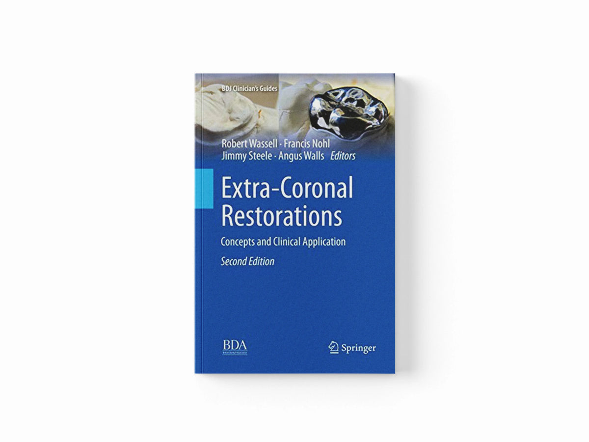 Extra-Coronal Restorations; 9783030077259